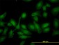 SCHAD / HADHSC Antibody (clone 4B5)